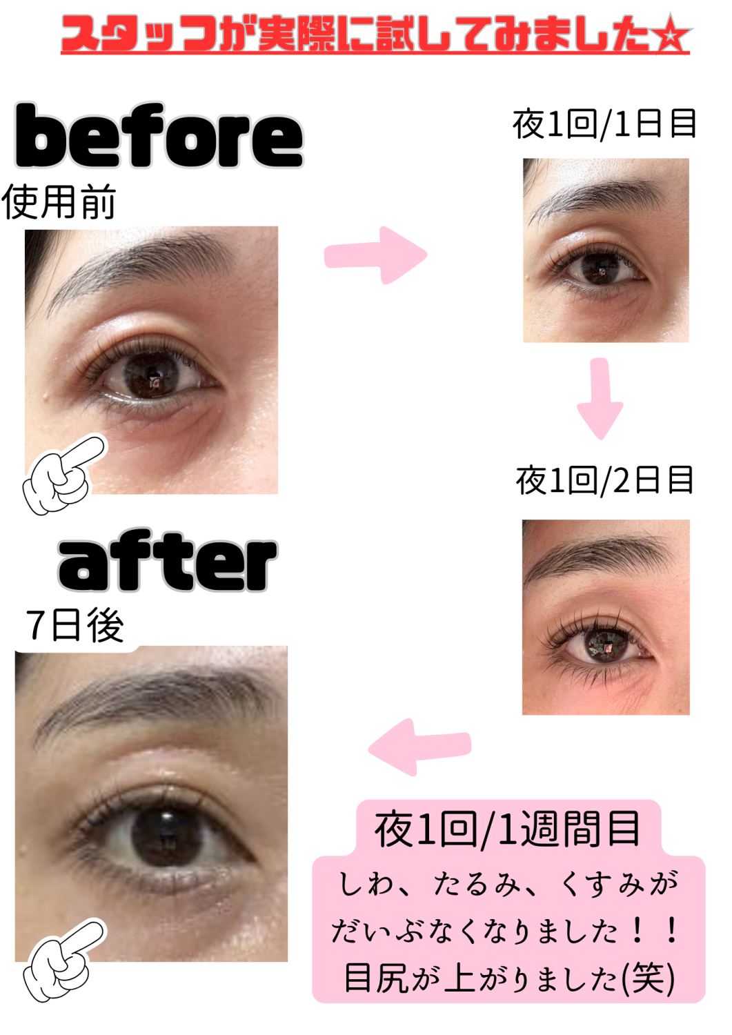 完売必須☆彡美顔器付きアイクリーム☆彡
